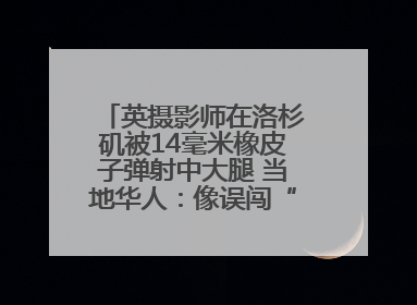 英摄影师在洛杉矶被14毫米橡皮子弹射中大腿 当地华人：像误闯“末日生存”游戏